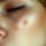 A close-up view of skin discoloration on a cheek.