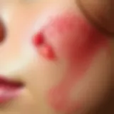 Close up of skin showing red bruises